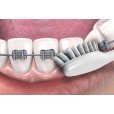 Зубная щетка GUM ORTHODONTIC