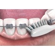 Зубная щетка GUM ORTHODONTIC